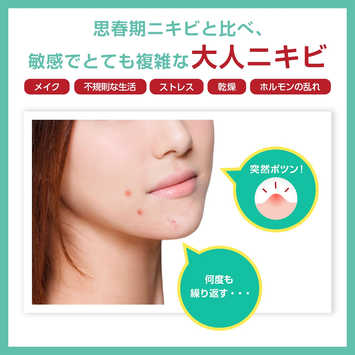 Amazon | アクネバリア 薬用プロテクトメイククリアN 大人ニキビ 予防